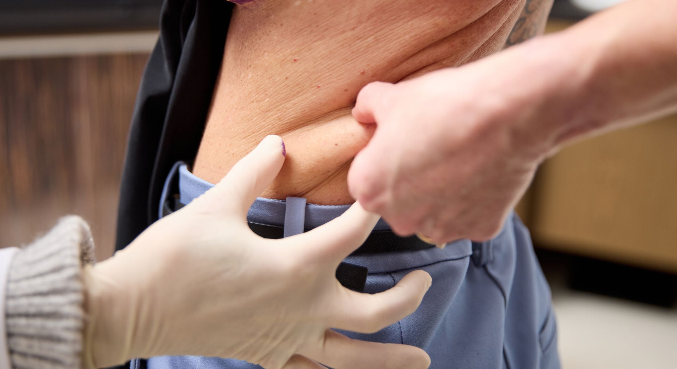 Medical examination of patient's lower back area.